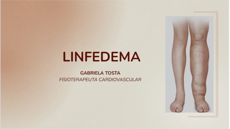 7 – Tudo sobre Linfedema